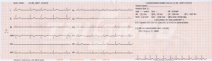 EKG Cardipia 400 Smart