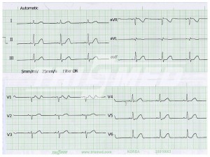 EKG Cardipia 200