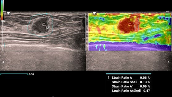 Natural Touch Elastography