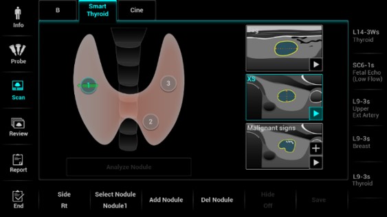 Smart_Thyroid1
