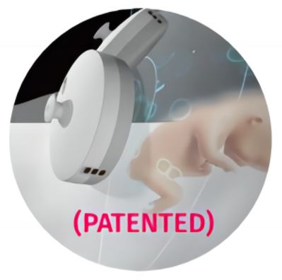 built-in-fetal-acoustic-stimulator